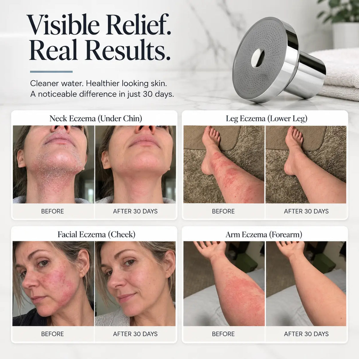 Roselyn™ Skin Barrier Shower Filter