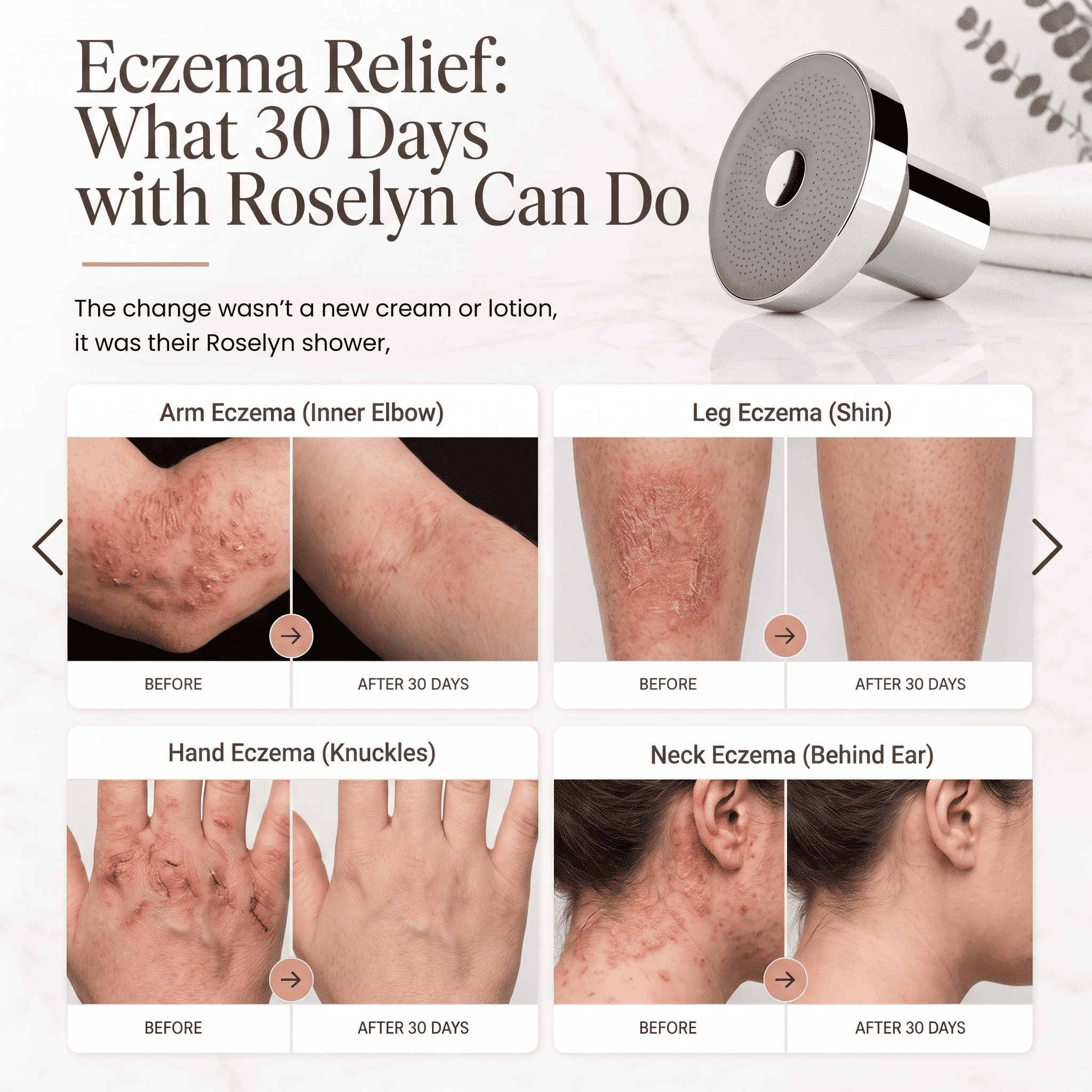 Roselyn™ Skin Barrier Shower Filter